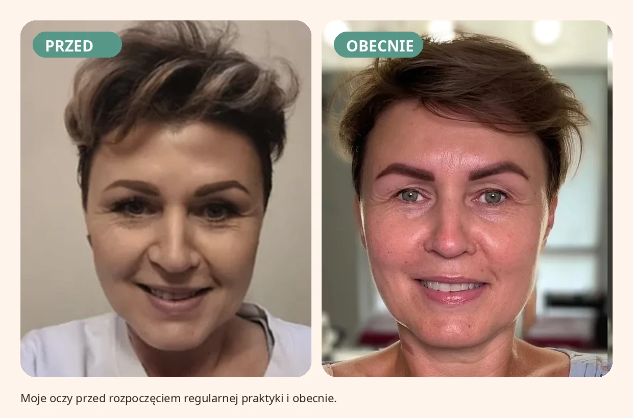 Porównanie okolicy oczu przed rozpoczęciem regularnej praktyki i obecnie